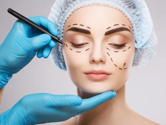 Eyelid Surgery (Blepharosplasty)