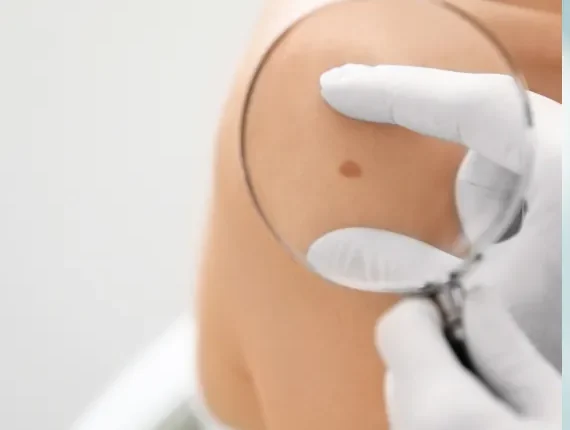 Skin Cancer Removal and Reconstruction