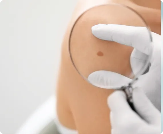 Skin Cancer Removal and Reconstruction